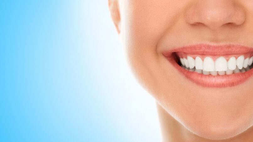 How to have White Teeth Naturally